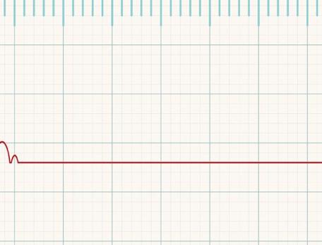 Flat Line