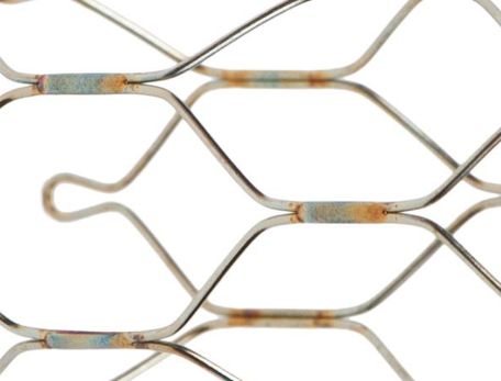 close-up of a vascular stent