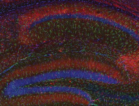 A section of the hippocampus of the brain