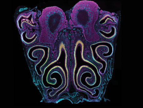 detail of an image of the brain highlighted with colors indicating sensory neurons for the detection of volatile odorants