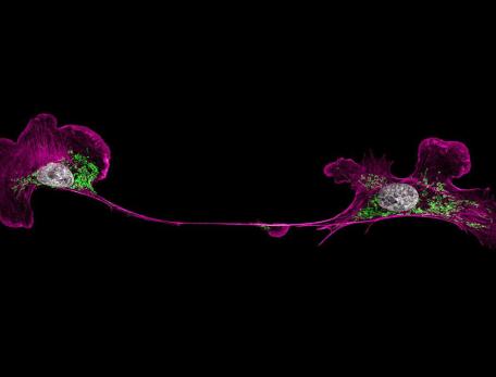 bright purple fluorescent proteins in a cell structure