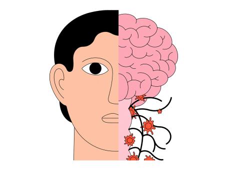 Illustration of a person's face and head with the right side showing the brain and nerve fibers.