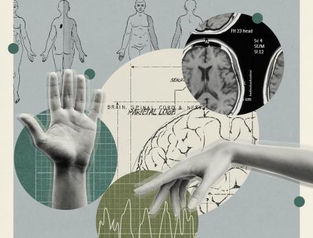 Collage of medical themes; anatomical drawings, a hand and fingers, brain scan, and brain diagrams. Tone is clinical, analytical, with green and gray hues.