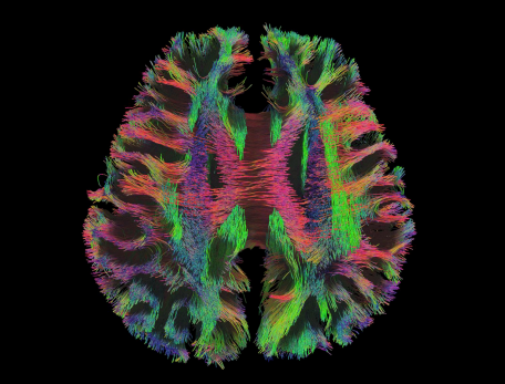Colorful visualization of brain neural pathways. The vibrant fibers resemble a complex weave, displaying various colors of reds, greens, and blues against a black background.
