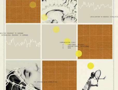 A collage of a brain scan, EEG lines, grid patterns, and a tennis player.