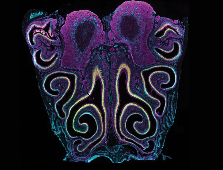 detail of an image of the brain highlighted with colors indicating sensory neurons for the detection of volatile odorants
