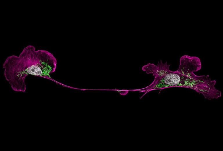 bright purple fluorescent proteins in a cell structure