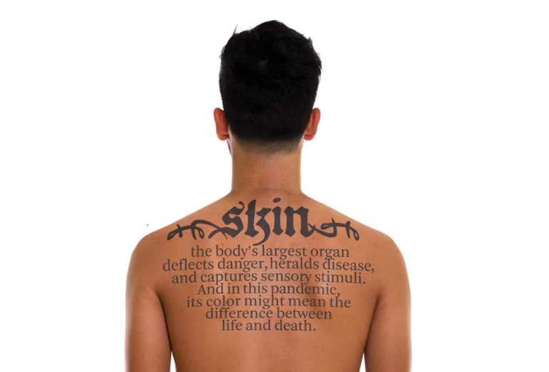 Back of a man with a large tattoo reading 'skin'