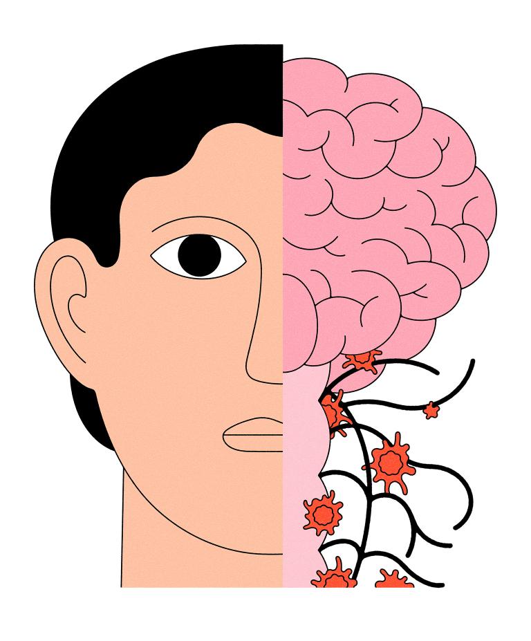 An Illustration of a person's head with half exposing the brain and nerve fibers.