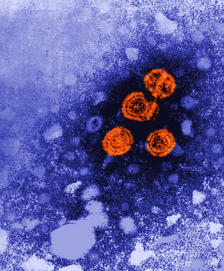 Transmission electron microscope image showing spherical Hepatitis B virus particles, highlighted in orange, against a textured blue background. The contrast coloring highlights the viral particles dispersed in the field, with a cluster of four particles.