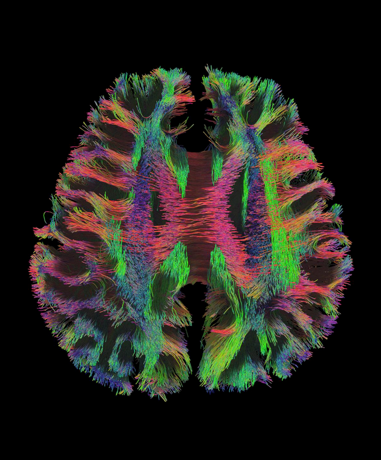 Colorful visualization of brain neural pathways. The vibrant fibers resemble a complex weave, displaying various colors of reds, greens, and blues against a black background.