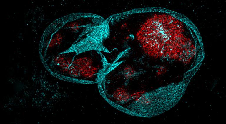 Micrograph of the nucleus of a human fibroblast