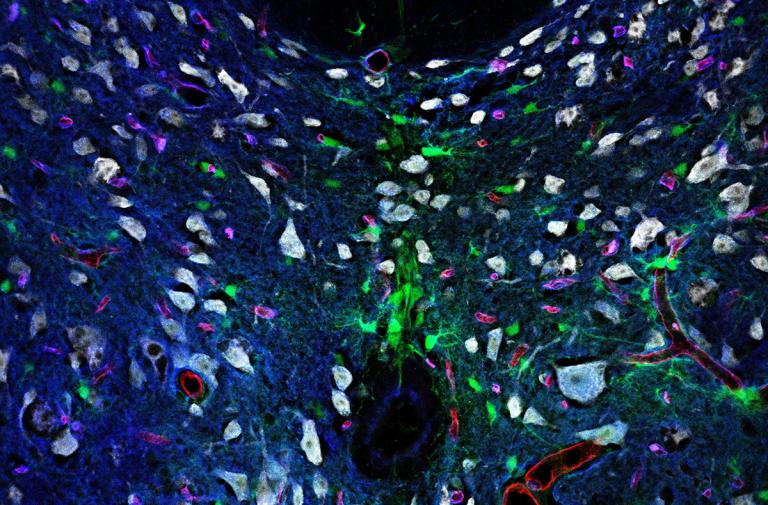 Micrograph of various cells in the gray and white matter of the spinal cord