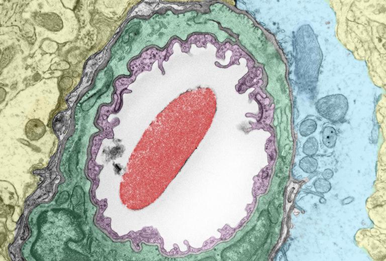 Scanning micrograph of an artery in the mouse brain