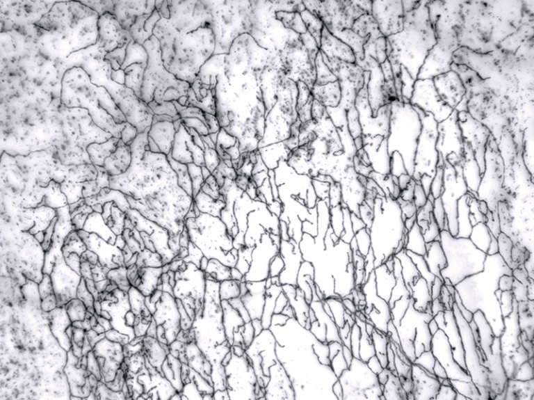 Single-labeled neuron