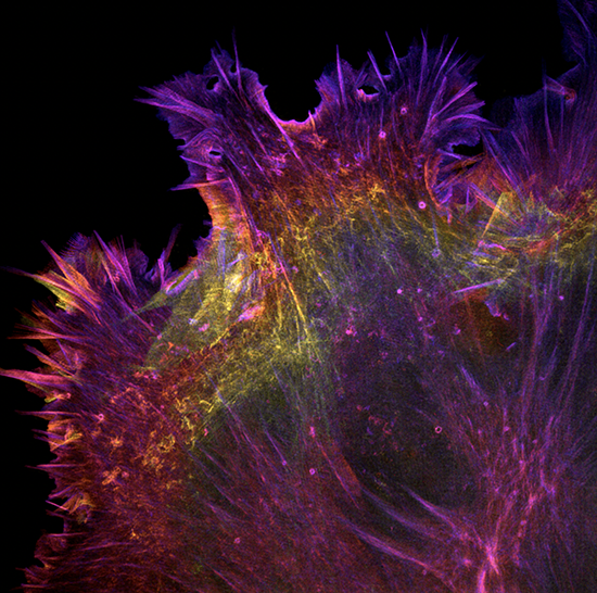 fluorescent proteins used to light up the cytoskeleton of a cell