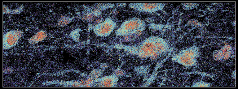 A microscopic image of RNA molecules being expressed in the human brain