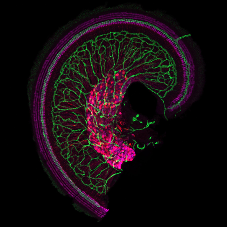 A microscopic image of the cochlea with vascular network highlighted in green