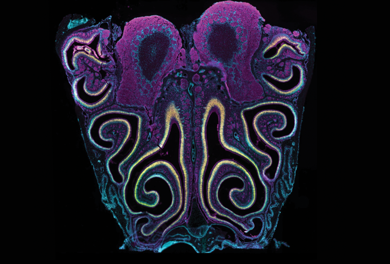 detail of an image of the brain highlighted with colors indicating sensory neurons for the detection of volatile odorants