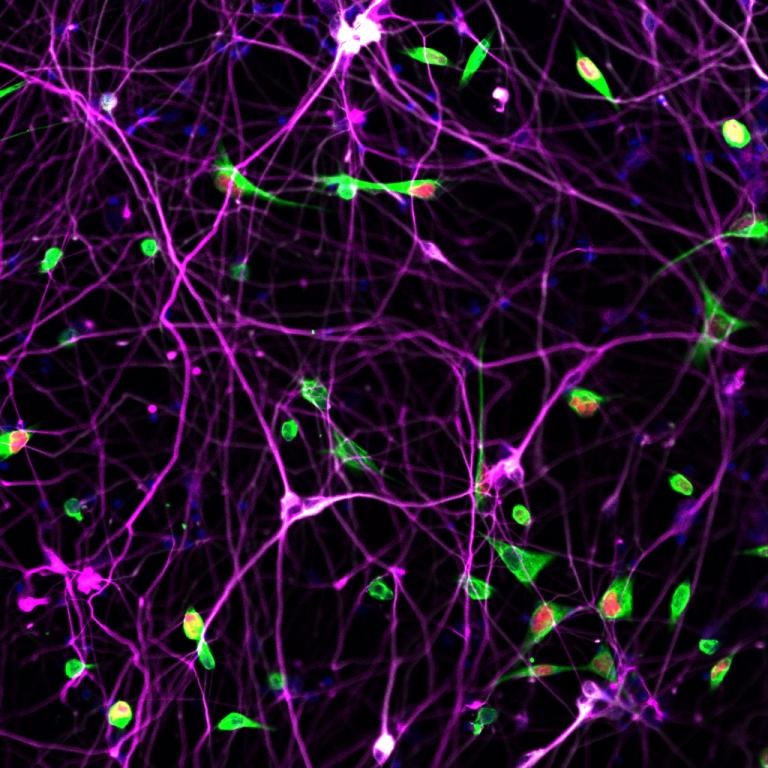 Bright green spots interspersed with purple glowing lines against a dark background