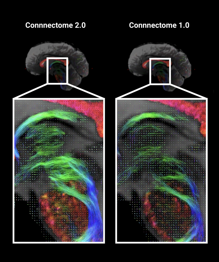 Comparison of neural networks in the Connnectome 2.0 and Connnectome 1.0, showing colorful neural pathways.