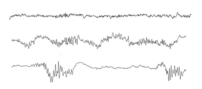 Three lines representing EEG signals. One is fairly flat with small oscillations. The second has larger oscillations. The third has very large oscillations interspersed with relatively flat line.