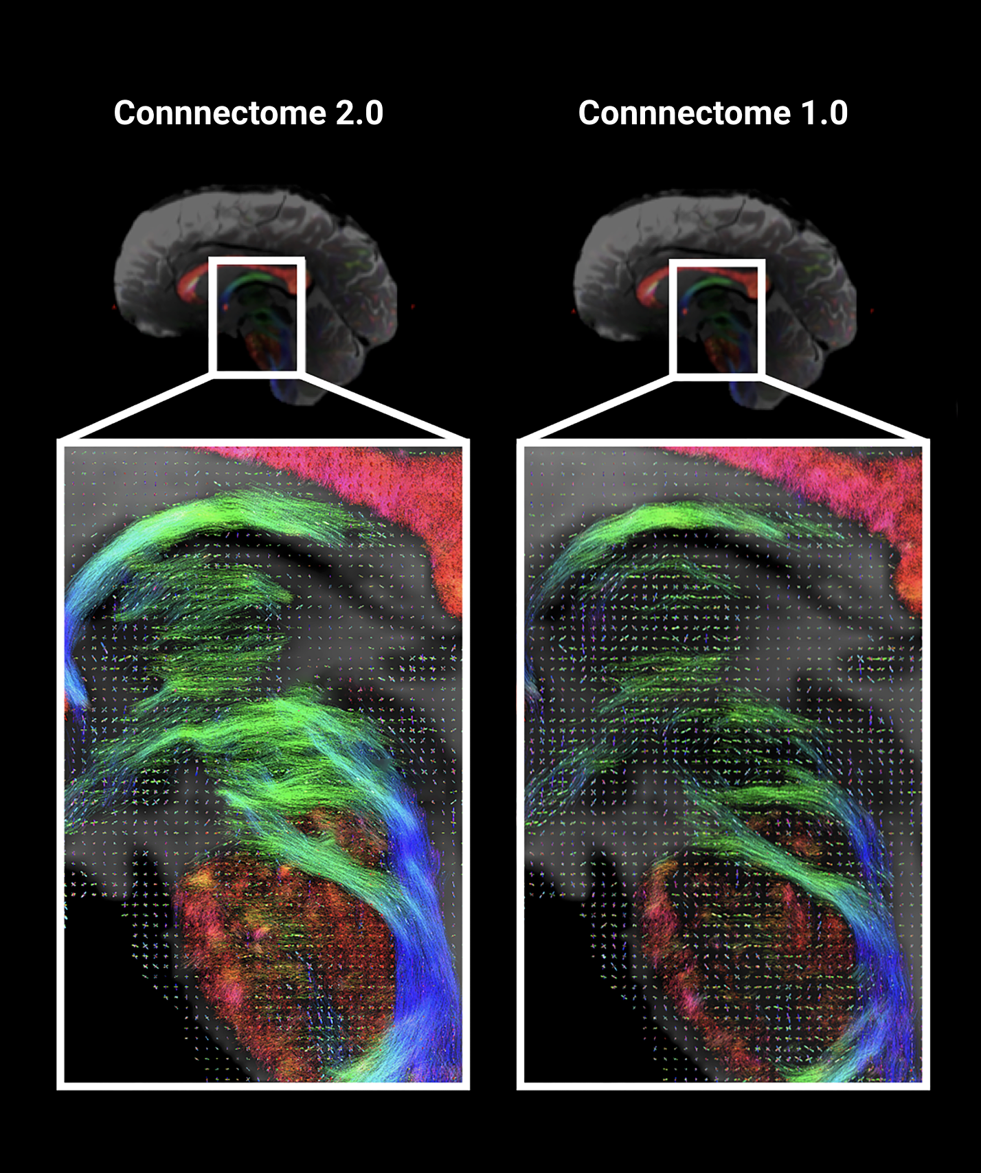 The Connectome 2.0 Scanner Captures the Brain in Unprecedented Detail ...