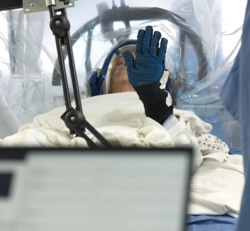 As part of the process of training a device developed by Precision Neuroscience, a patient moves his hand while sensors capture his brain signals.