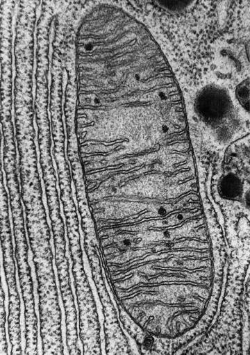 A black and white image of a mitochondrion in a cell