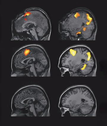 MRI brain scans in two rows show distinct regions of orange-yellow highlighted areas, indicating active brain regions against a black background.